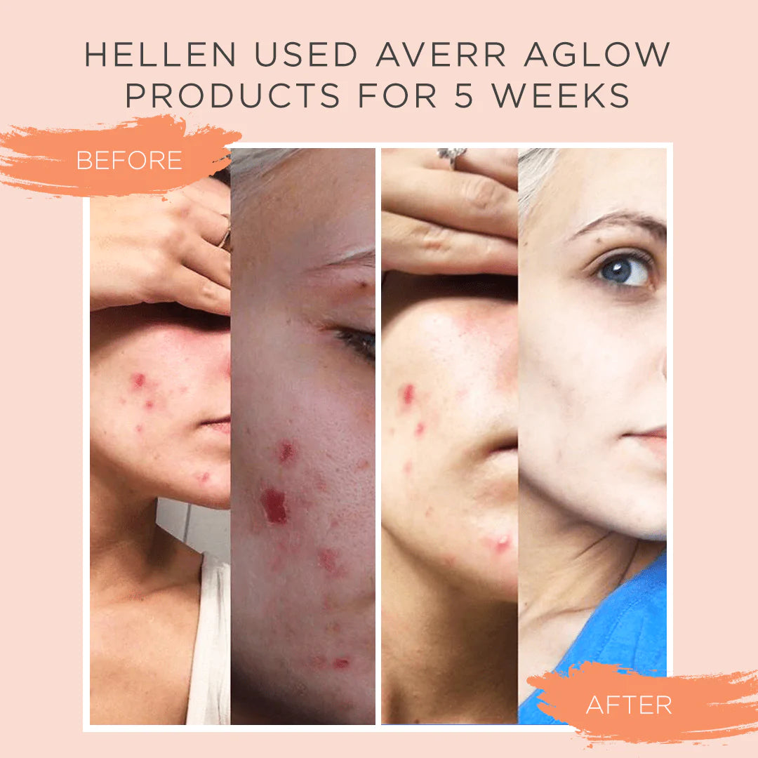 No. 3 Clear Skin Elixir-Averr Aglow