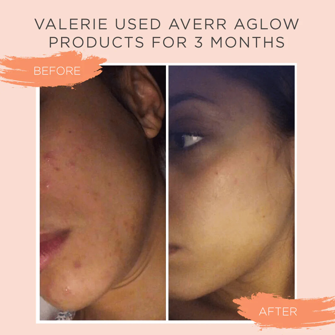 Perfectionist Overnight Serum Averr Aglow